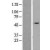 Western Blot: Cytokeratin 14 Lysate [NBL1-12381] - Western Blot experiments. 
Left-Control; Right -Over-expression Lysate for KRT14